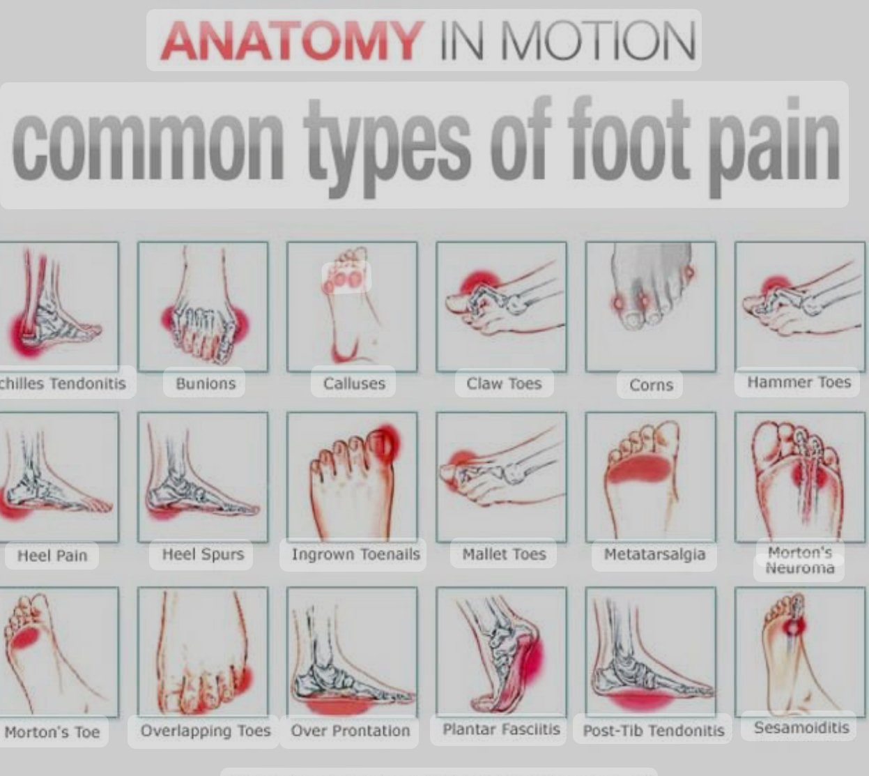 Foot Pain