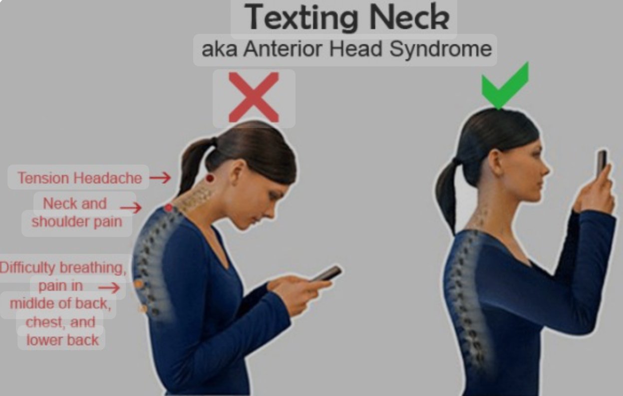 The Impact Of Phone Addiction On Cervical Spine And Its Physiotherapy Management