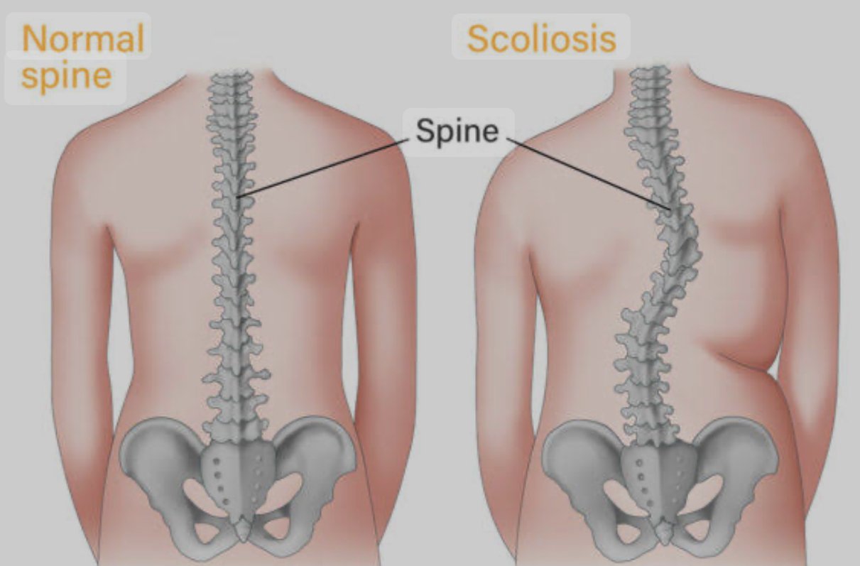 Physiotherapy Management of Posture-Related Musculoskeletal Pain